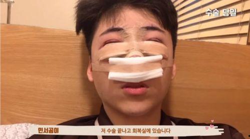 整容网红爆料视频播放,视频播放背后的惊人真相